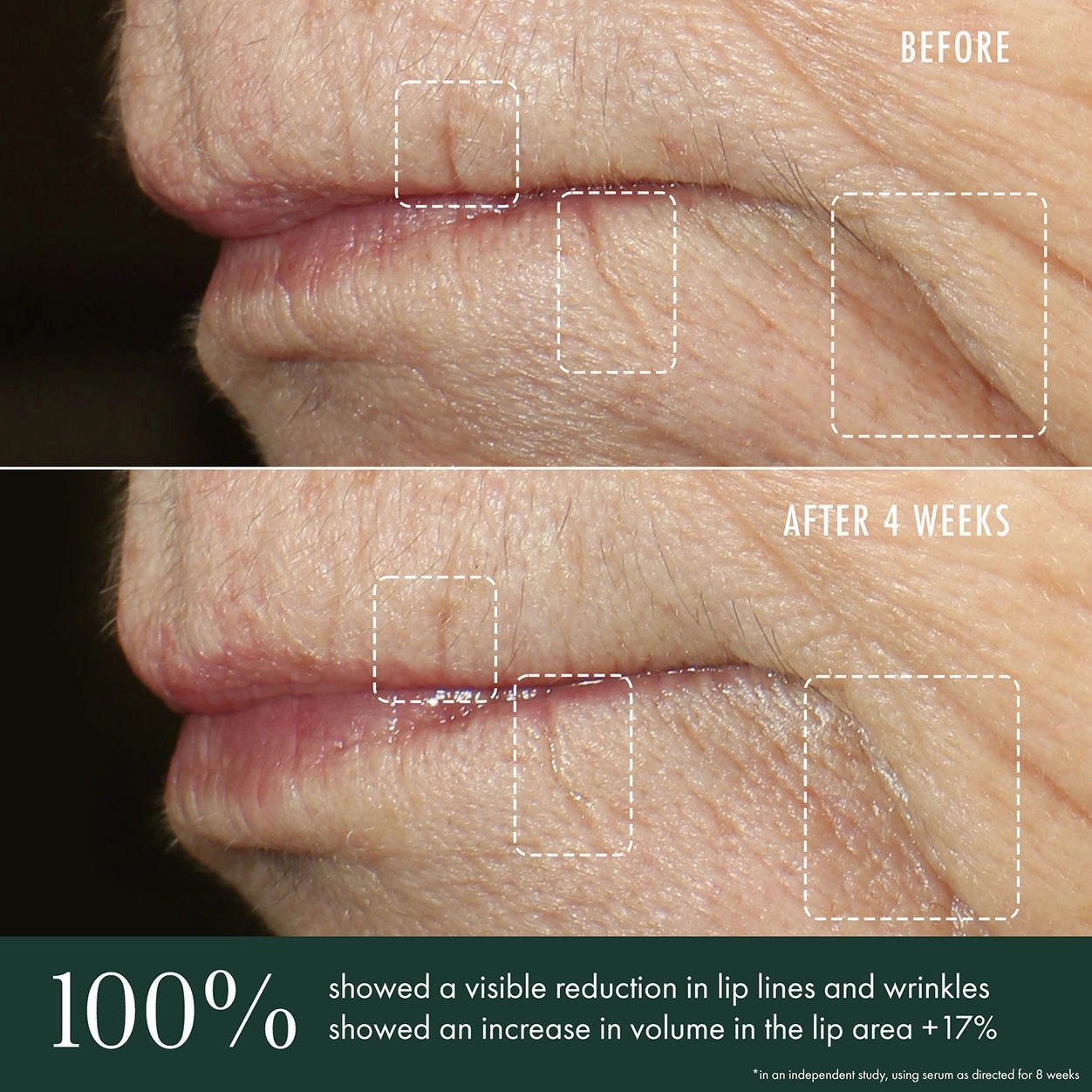 Advanced Lip Perioral Serum Targeted Vertical Line Filler
